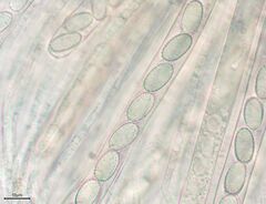 Peziza echinospora