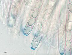 Peziza echinospora