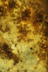 Xanthoriicola physciae