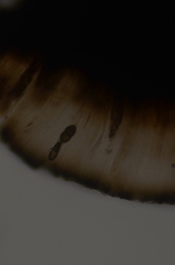 Rhizocarpon hensseniae