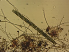 Pleurotaenium trabecula