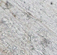 Stropharia pseudocyanea