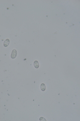 Caloplaca atrosanguinea