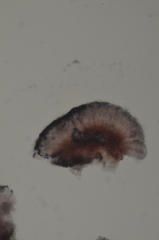 Caloplaca atrosanguinea