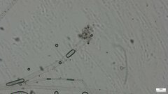 Choanephora infundibulifera