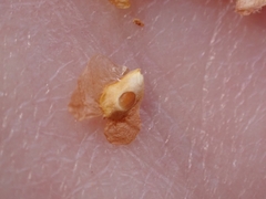 Semudobia betulae