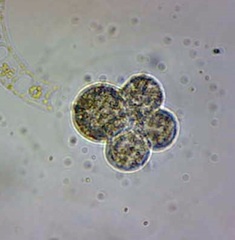 Globigerina