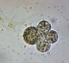 Globigerina