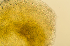 Pezizellaceae