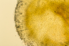 Pezizellaceae