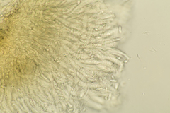 Pezizellaceae