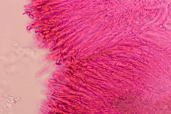 Pezizellaceae