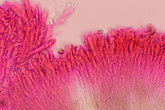 Pezizellaceae