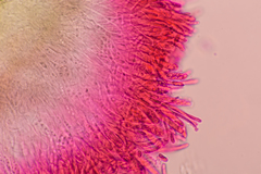 Pezizellaceae