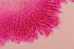 Pezizellaceae