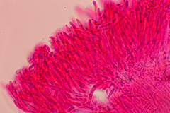 Pezizellaceae
