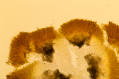 Pezizellaceae