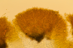 Pezizellaceae