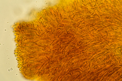Pezizellaceae