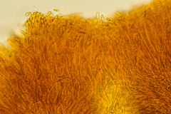 Pezizellaceae