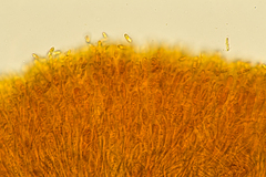 Pezizellaceae