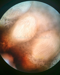 Balansiopsis guaduae