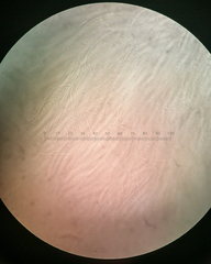 Balansiopsis guaduae