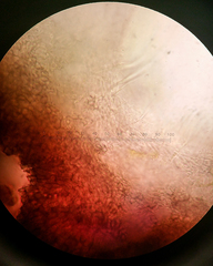 Balansiopsis guaduae