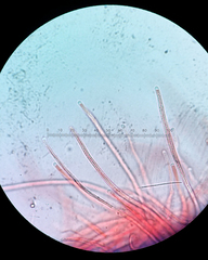 Balansiopsis guaduae