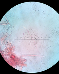 Balansiopsis guaduae