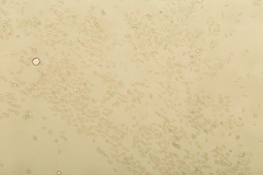 Stachybotryaceae