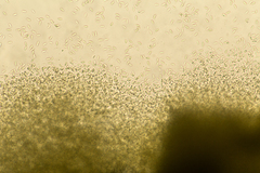Stachybotryaceae