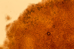 Stachybotryaceae
