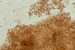 Stachybotryaceae