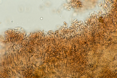 Stachybotryaceae