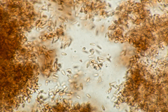 Stachybotryaceae