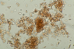Stachybotryaceae