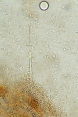 Stachybotryaceae