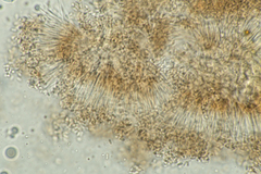 Stachybotryaceae