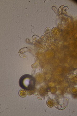 Phragmidium bulbosum