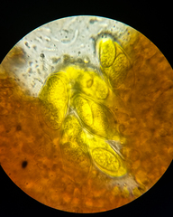 Phyllactinia guttata