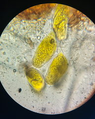 Phyllactinia guttata