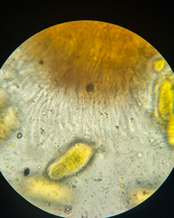 Phyllactinia guttata