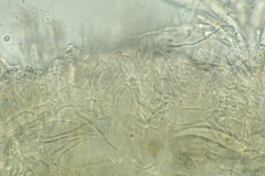 Arachnoscypha aranea