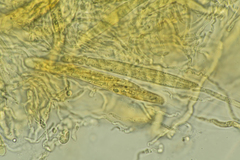Cercophora lanuginosa