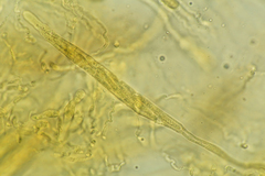 Cercophora lanuginosa
