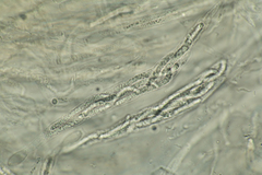 Cercophora lanuginosa