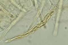Cercophora lanuginosa
