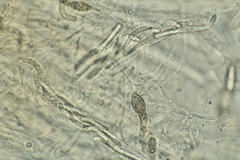 Cercophora lanuginosa