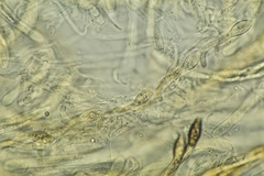 Cercophora lanuginosa